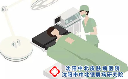 皮膚過敏會轉為銀屑病嗎