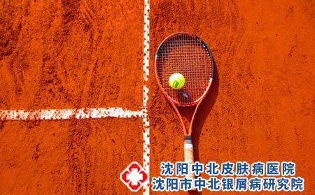 兒童得了銀屑病能用激素嗎