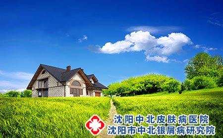 頑固性銀屑病怎么治療,4個小妙招幫你輔助對抗銀屑病
